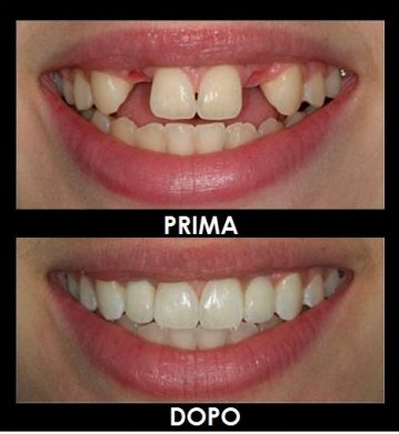 Impianti prima e dopo